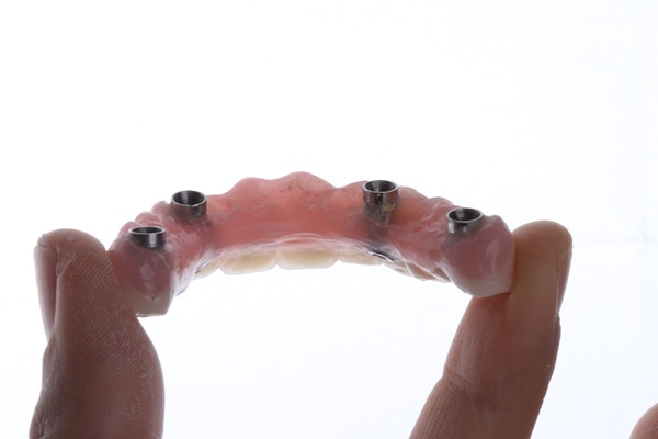 Benefits Of All On   Implants