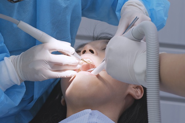 Signs You May Need A Deep Teeth Cleaning